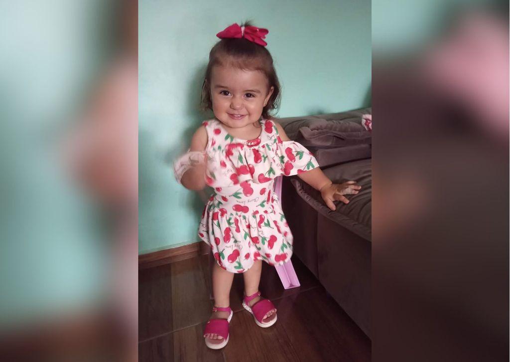 Menina de 2 anos que ingeriu soda cáustica recebe alta do hospital